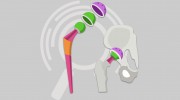 Medical Device Recruiters